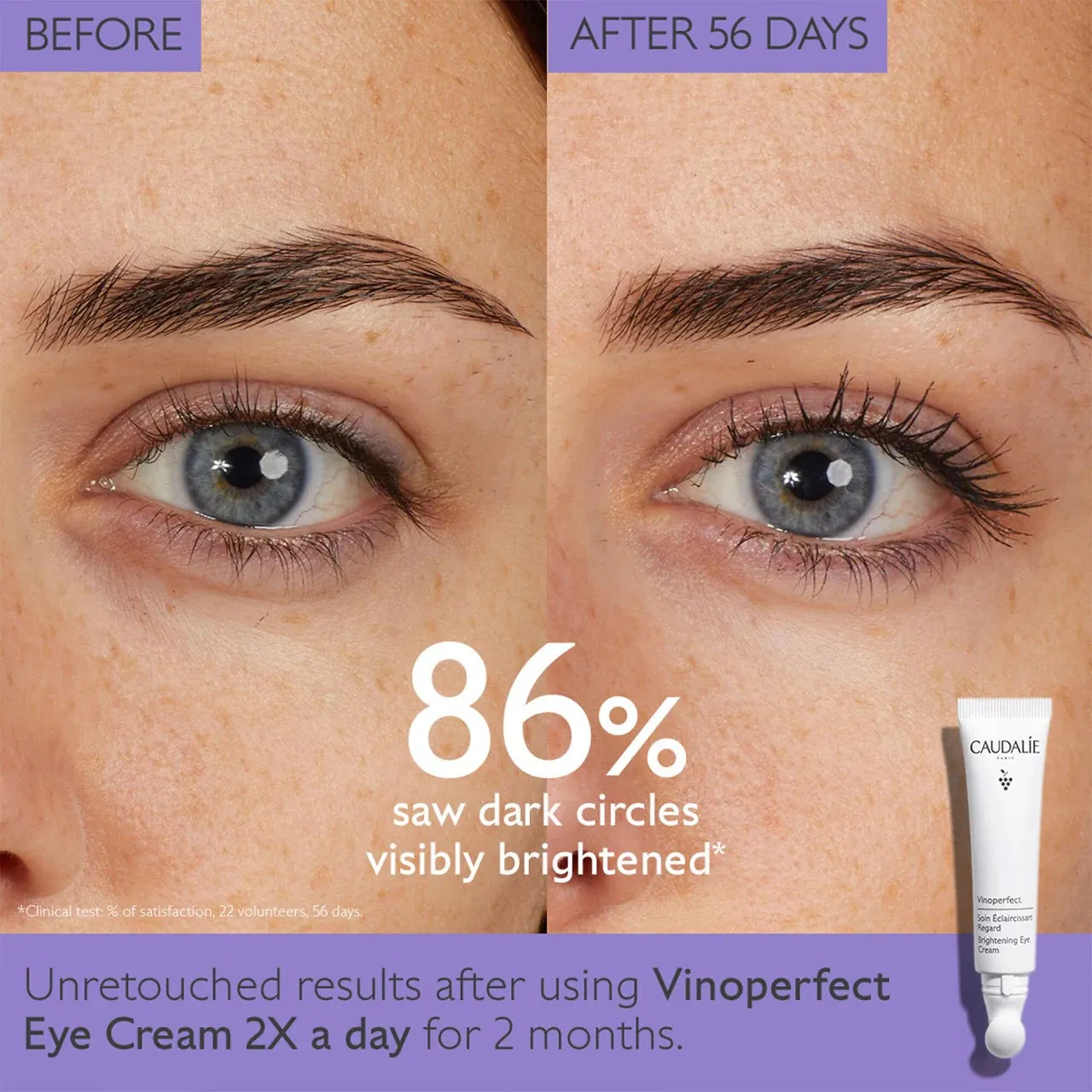 Caudalie Vinoperfect Dark Circle Brightening Eye Cream 15ml NIB