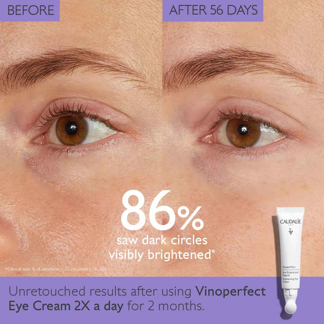Caudalie Vinoperfect Dark Circle Brightening Eye Cream 15ml NIB
